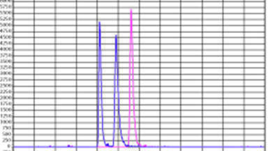 Online Solid Phase Extraction and LC-MS Analysis of Thyroid Hormones in Human Serum
